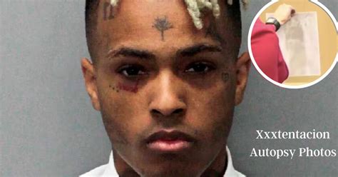 xxxtentacion autopsy photos leaked|XXXTENTACION Unseen Photos Surface